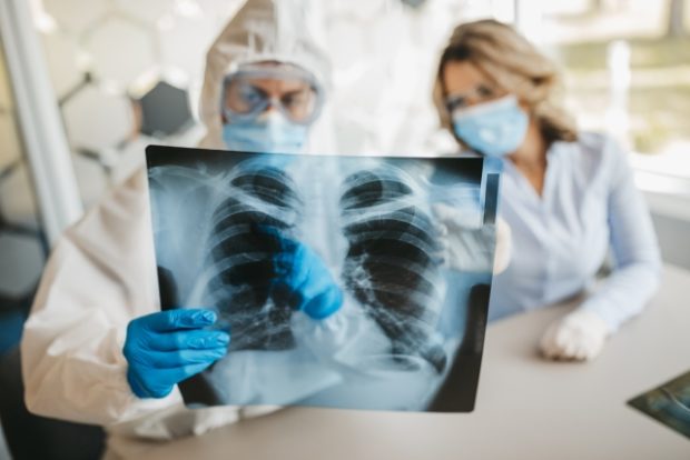 x-ray